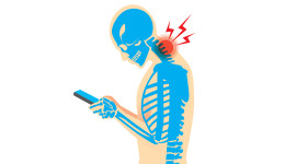 Text neck